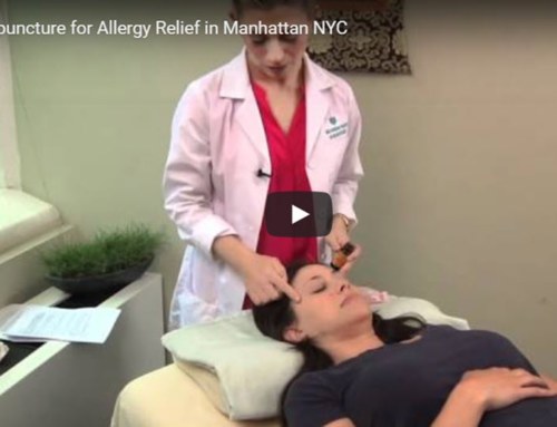 Acupuncture for Allergy Relief