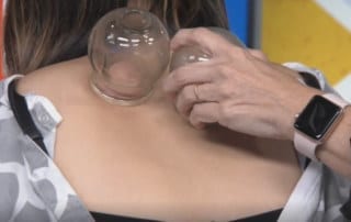 Cupping Ancient Treatment